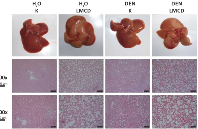 Abbildung 7: Bestimmung des Steatosegrads der Lebern der C3H/HeNRj-Mäuse nach H 2 O/DEN-Injektion  und 16-wöchiger Fütterung der LMCD/K-Diät