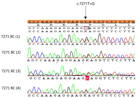 Figure 1: Sequencing results of the 7271 BC patients; the mutant position  is indicated by the arrow; the normal DNA sequence is shown in the upper  orange line  
