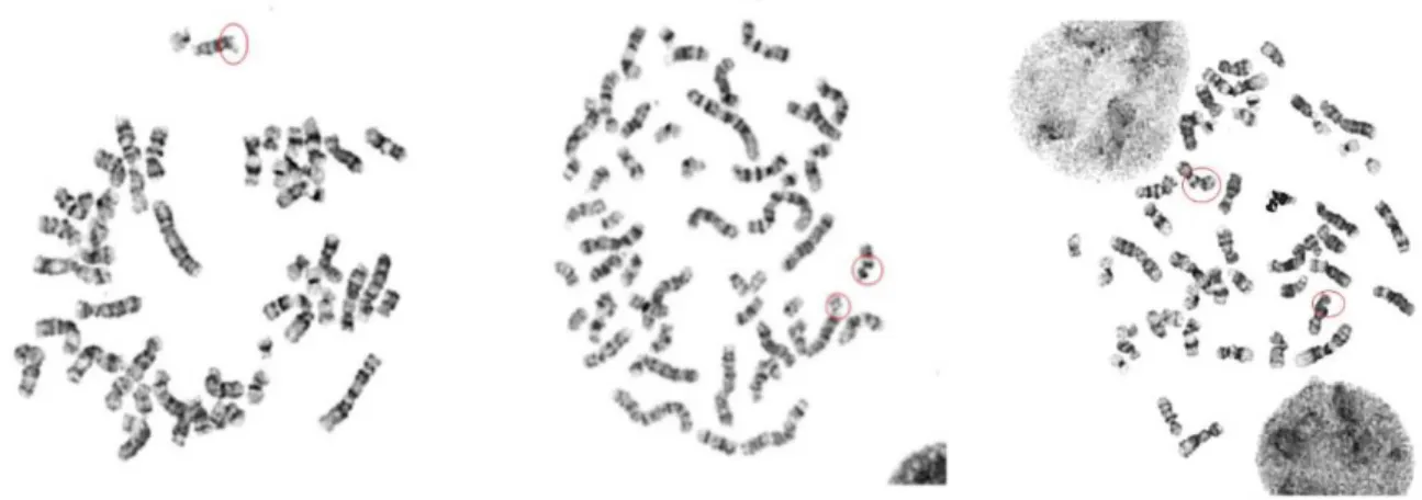 Figure 7: Exemplary metaphases stained with Giemsa showing chromosomal breaks (indicated by red circles) 