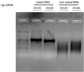 Figure  7:  Example  of  a  RNA  agarose  electrophoresis.  300ng  mRNA  were  loaded  either  after  PolyA-tailing  (tailed RNA) or before (non-tailed RNA)