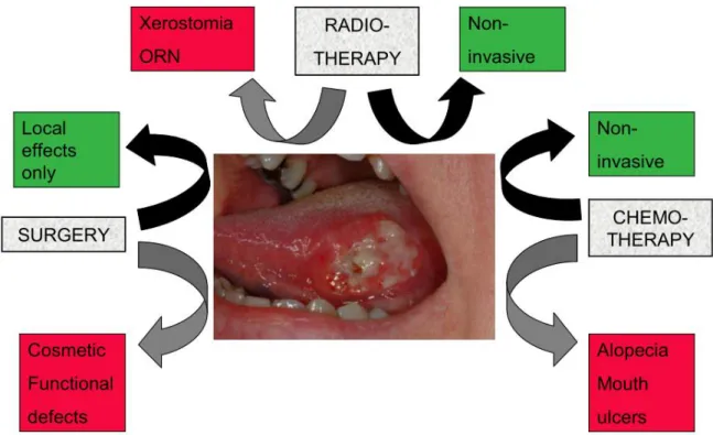 Abbildung  1:  Therapieoptionen  bei  oralem  Plattenepithelkarzinom  und  ihre  Hauptkomplikationen  (Bildquelle:  Scully  &amp; 