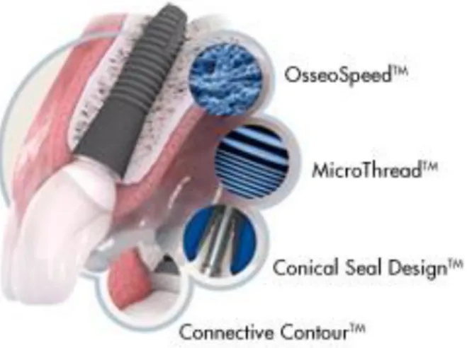 Abbildung  2:  Die  4  Elemente  des  ASTRA  TECH  Implant  System  BioManagement  Complex™  (Bildquelle:  DENTSPLY  Implants, 2018) 