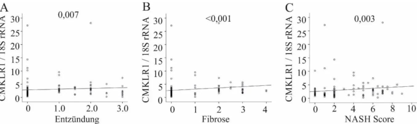 Abbildung 6A) und zwischen CMKLR1 und der Fibrose (s.  Abbildung 6B). Auch nahm die  Menge  an  CMKLR1  mRNA  mit  steigendem  NASH  Score  immer  weiter  zu  (s
