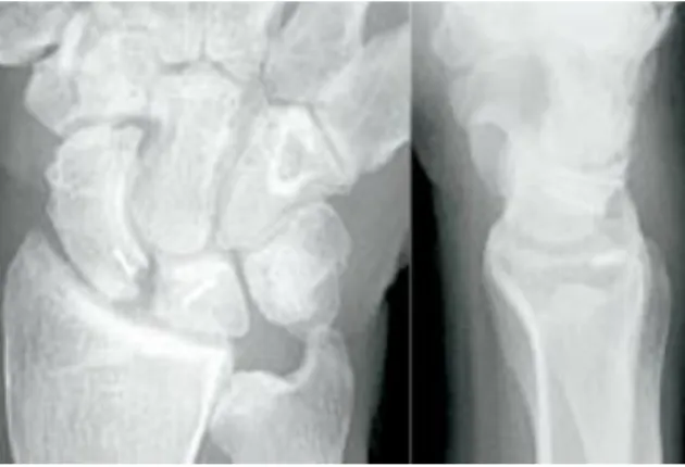 Abbildung 11: Röntgenbilder zwei Jahre postoperativ 