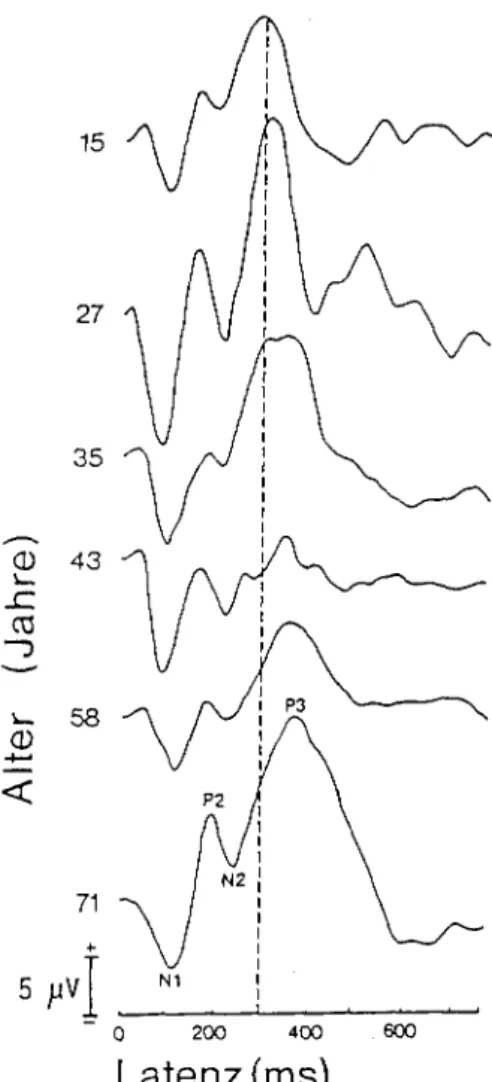 Abbildung  6:  Latenzerhöhung  des  P300-(P3)-Potentials  (Zentralableitung)  über  verschiedene  Altersstufen  in  einer  Zählaufgabe  mit  akustischem  Hinweisreiz;  die  Amplituden  zeigen  keinen   eindeu-tigen  Alterszusammenhang;  (nach  Polich  und 