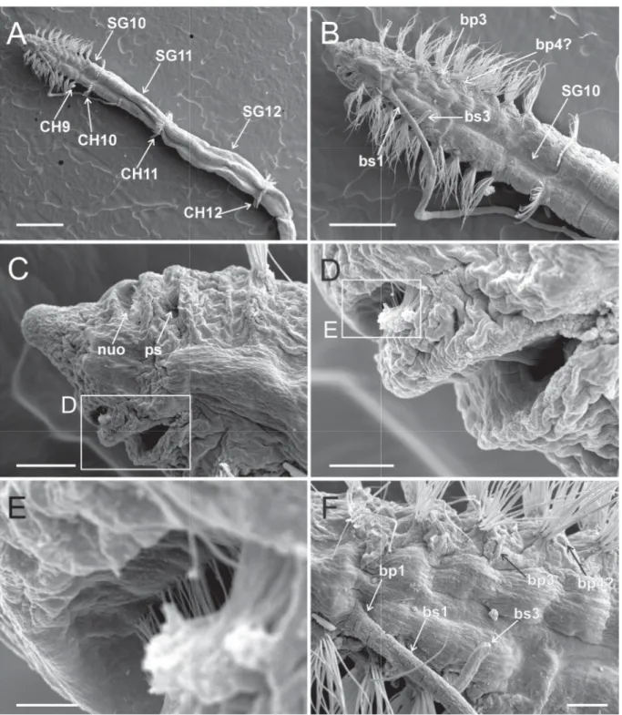 Fig. 6. Heterospio indica sp. nov., paratype (MNCN 16.01/17000), SEM micrographs. A. Anterior end,  dorsal view (scale bar = 500  μ m)