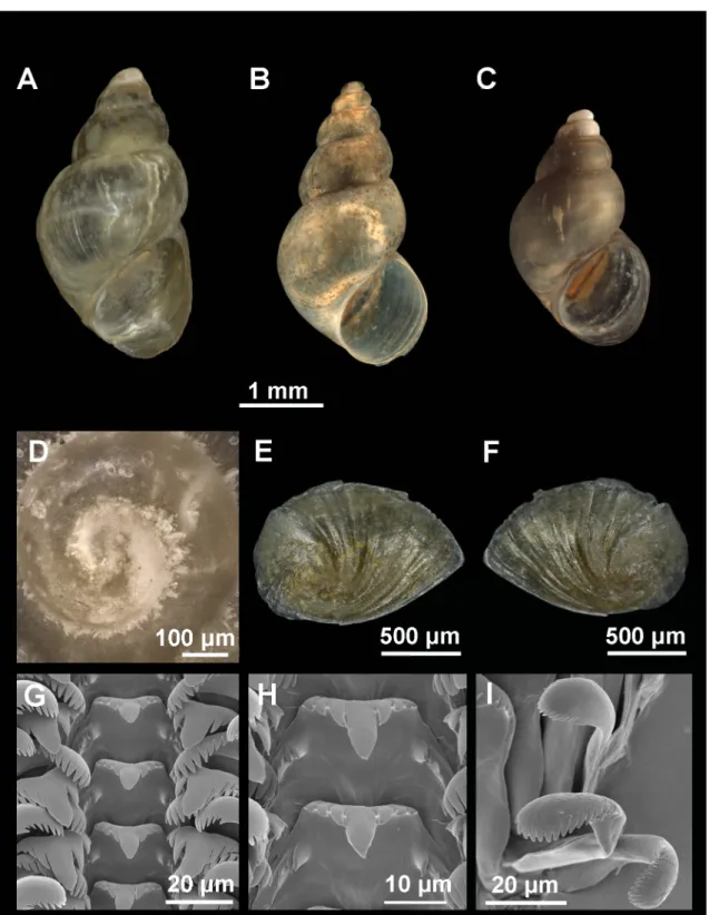 Fig. 8. Shell, operculum and radula of Shadinia terpoghassiani (Shadin, 1952) from Lake Aiger-Lich,  Armenia