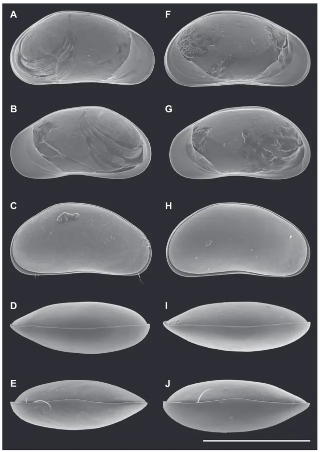 Fig. 2. Valves of Pseudocandona agostinhoi sp. nov. A–E  ♂ and F–J ♀.  A, F. LV, internal view (A =  MZUSP 32655, F = OC