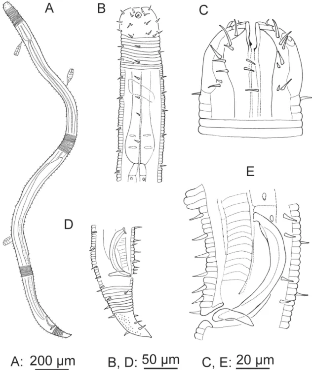 Fig. 4. Croconema cinctum Cobb, 1920, ♂ specimen 1 (A, B &amp; D) and specimen 2 (C &amp; E)