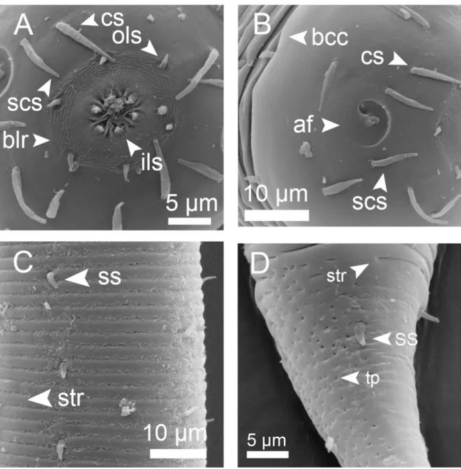 Fig. 5.  Croconema cinctum Cobb, 1920, SEM microphotographs of ♂ specimen 1 (A, B &amp; D) and  specimen 2 (C)