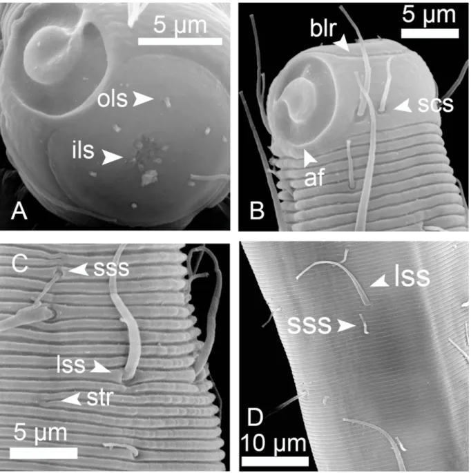 Fig. 3. Bolbonema brevicolle Cobb, 1920, SEM microphotographs of ♂ (A) and ♀ (B, C &amp; D)