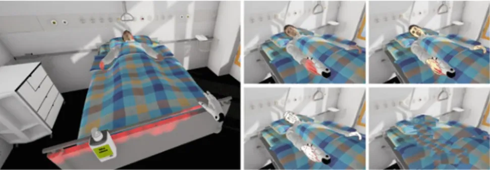 Fig. 3.2 Left: Microorganism visualization on patient bed rail. Right: Visual portrayal of time- time-warping