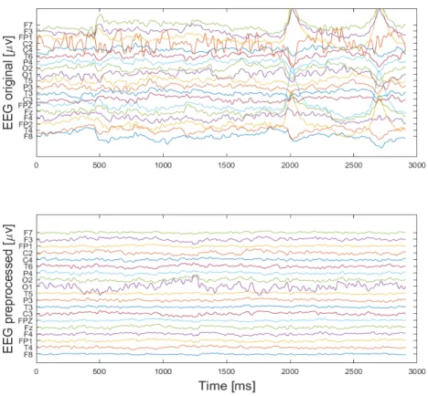 Figure 2.4: Visualization of single trial EEG data. (top) Subset of the raw EEG data during the sentence.