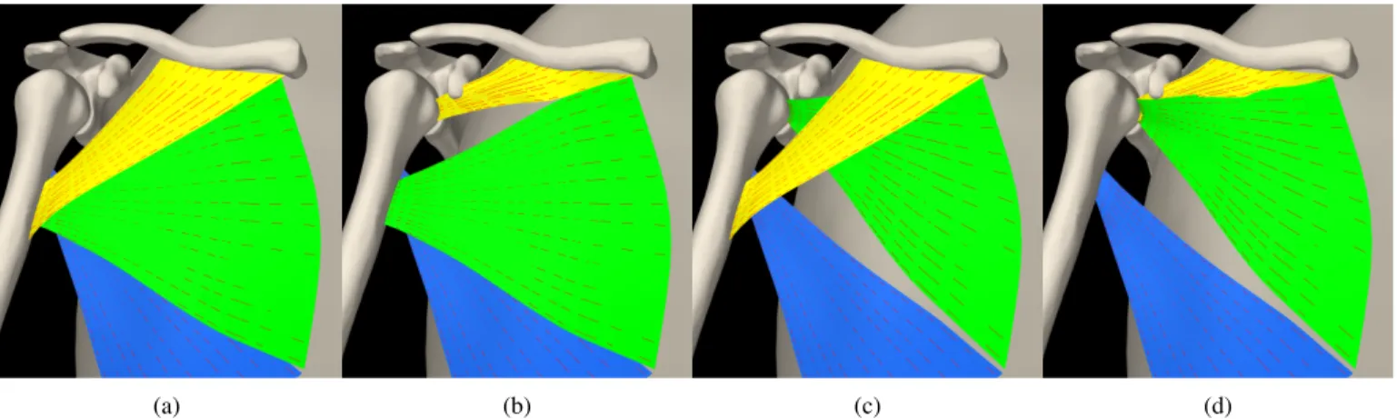 Fig. 1: Intact PMA (a) simulated transfer of (b) clavicular part, (c) sternal part, and (d) sternoclavicular part