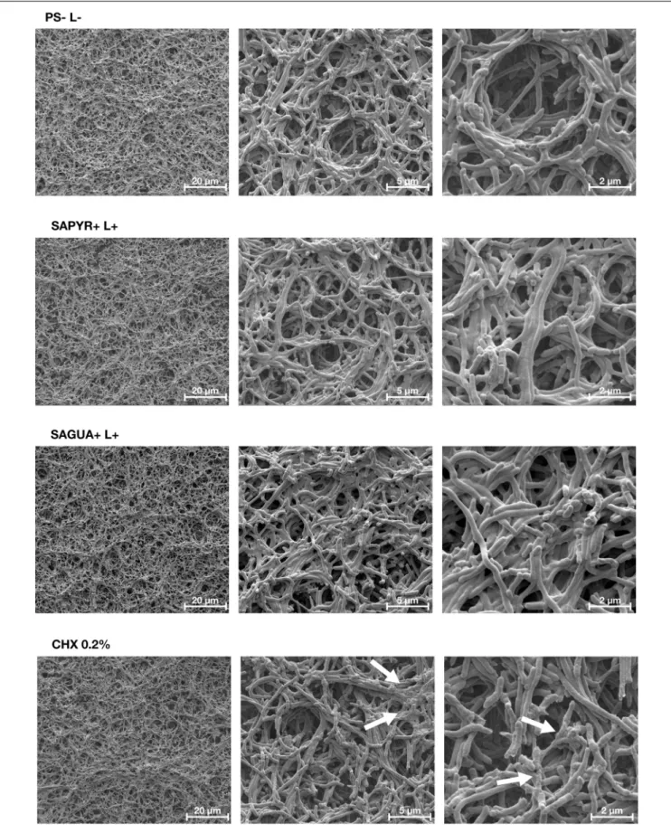 FIGURE 5 | Exemplary visualization of polymicrobial biofilms by means of scanning electron microscopy