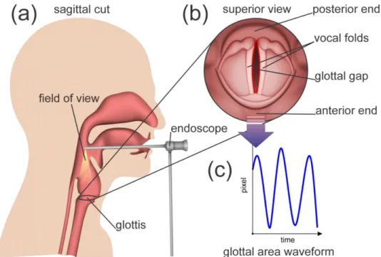 Figure 1. (a) Recording of the vocal fold oscillations via a rigid endoscope being attached to a high- high-speed camera