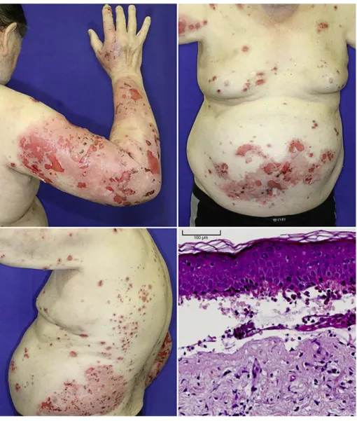 Fig. 1.  Clinical presentation and H&amp;E staining. 