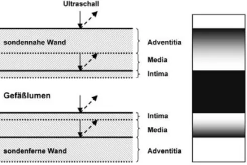 Abbildung 7 Darstellung des unterschiedlichen Verhaltens der Schallwellen an der sondennahen und an  der sondenfernen Gefäßwand