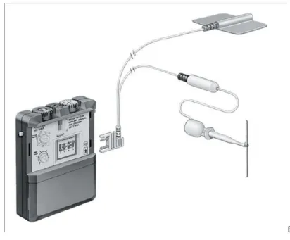 Abbildung 6: Teststimulator mit Kabel und angedeuteter Stimulationsnadel, Medtronic®; GmbH, Emanuel-Leutze-Str