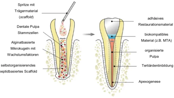 Abbildung 2: Beispielhafte Darstellung von Tissue Engineering in der Zahnheilkunde. Abgewandelt nach (171) 