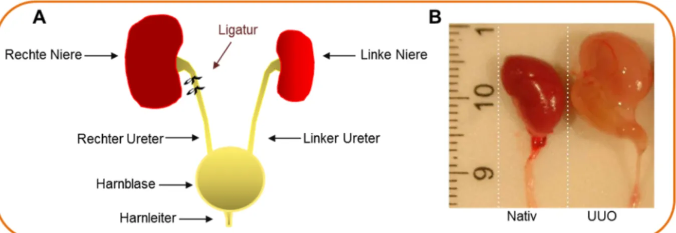 Abb. 1.7 Modell der unilateralen Ureterobstruktion (UUO). (A) Schematische Darstellung  der UUO