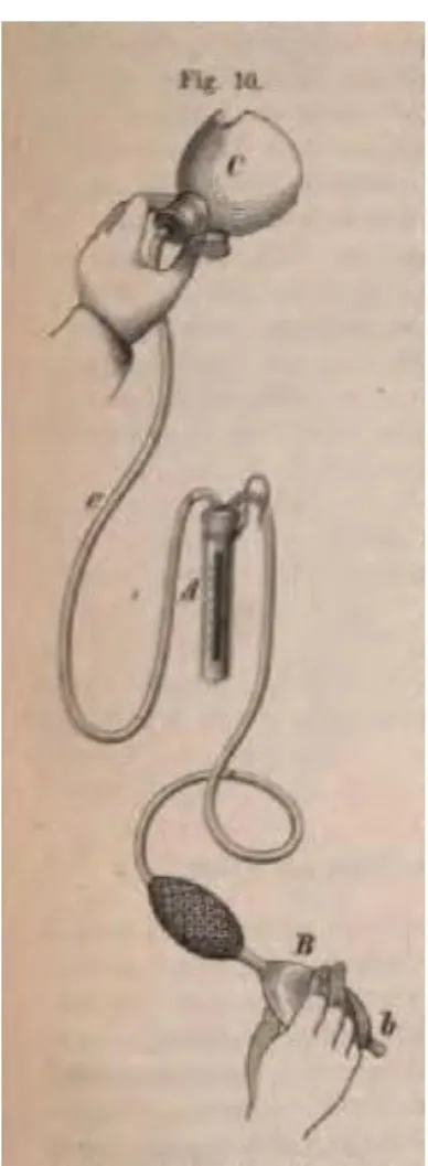 Abbildung 7: Abbildung aus dem Lehrbuch für operative Gynäkologie von                        Kaltenbach und Hegar