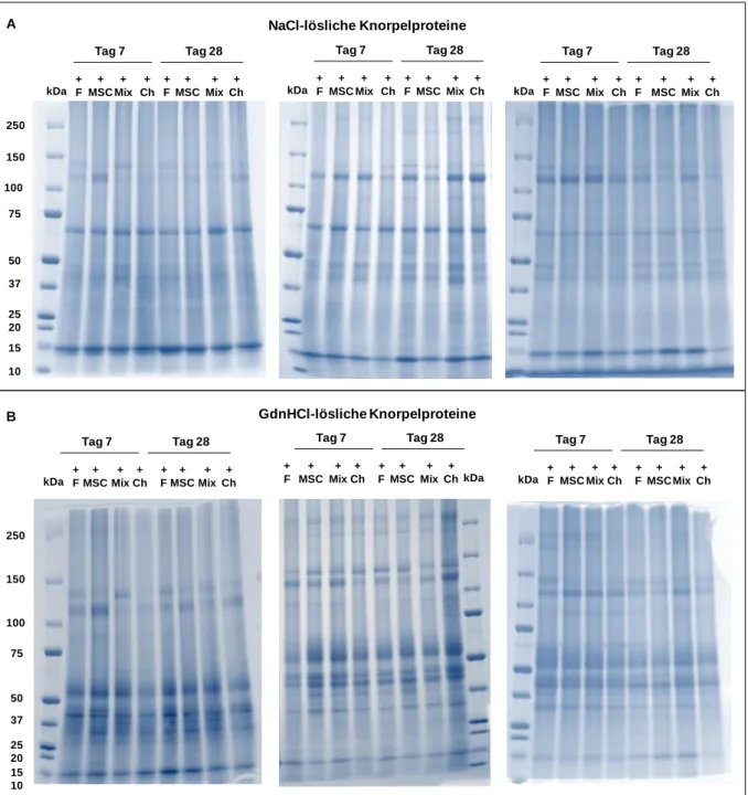 Abb.  17  Coomassie-Blau-Färbung  von  Proteinbanden  (mono-  und  kokultivierte  OA-Knorpel- OA-Knorpel-explantat-Proteinextrakte) 