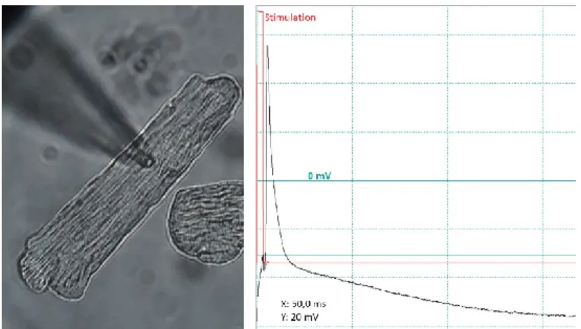 Abbildung 12: Patch-Clamp Untersuchung. In der Abbildung links stellt sich die Patchpipette  (Schatten) nach erfolgreichem Seal und Rupture während einer Aktionspotentialmessung (rechts)  eines  isolierten  Kardiomyozyten  dar  (angelegter  Strom:  -31 pA,