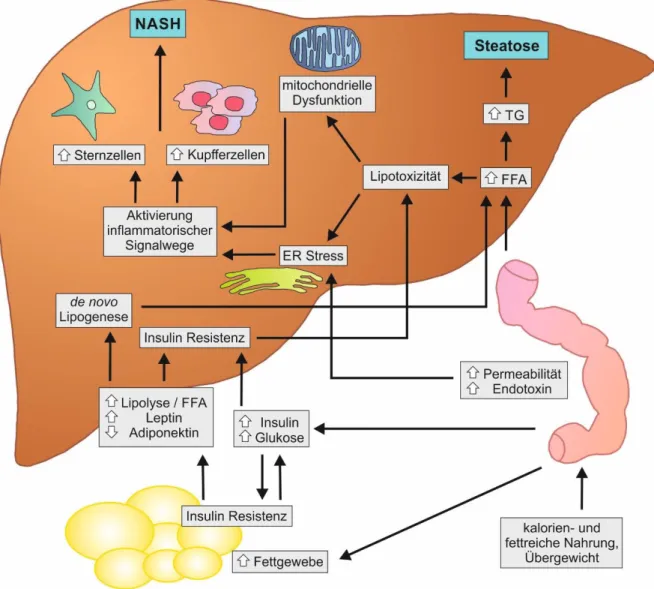 Abbildung  2:  NAFLD-Pathogenese  nach  der  multiple-hit  Hypothese  (nach  [26,  29])