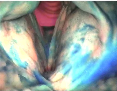 Abbildung 8. Endoskopische Schluckdiagnostik – Videobefund der Untersuchung 
