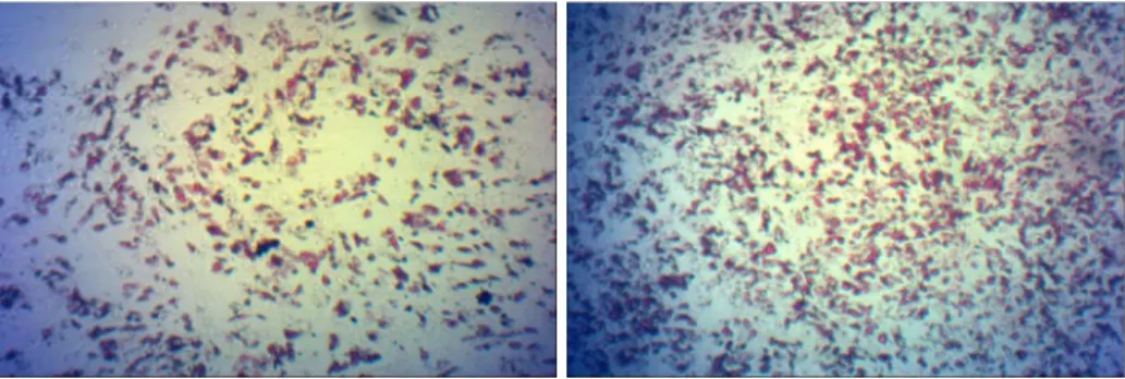 Abbildung  10:  Lichtmikroskopische  Aufnahmen  der  Oil  Red  Färbung  von  Adipozyten  eines  Patienten nach 3-wöchiger adipogener Differenzierung