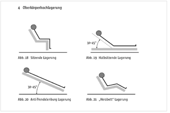 Abbildung 1: Oberkörperhochlagerung aus Bein, T.: Lagerungstherapie in der Intensivmedizin: MWV Medizinisch Wiss