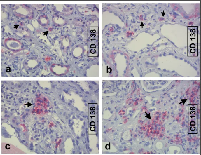 Abbildung 19 CD138 positive, interstitielle Zellen (►).Verteilungsmuster:  a,b vereinzelt