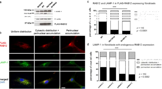 Figure 3.  RAB12  mutations changed  the  subcellular  localization of  RAB12 proteins and lysosomes. 
