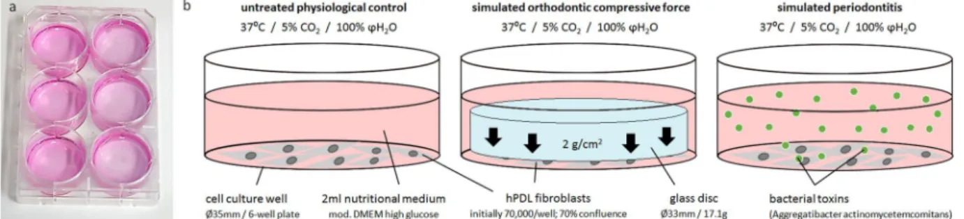 Figure 5.  Experimental setup for the hPDL fibroblast experiments. (a) 6-well cell culture plate with untreated  controls and simulated periodontitis (left side) as well as simulated orthodontic compressive force (right side)