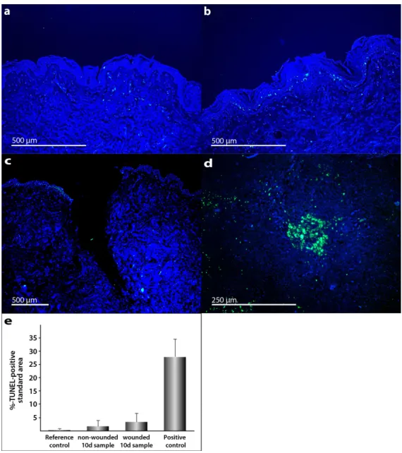 Figure 3. Detection of apoptosis in human full-thickness skin graft cross sections: TUNEL staining  merged with DAPI counterstaining was used for apoptosis detection