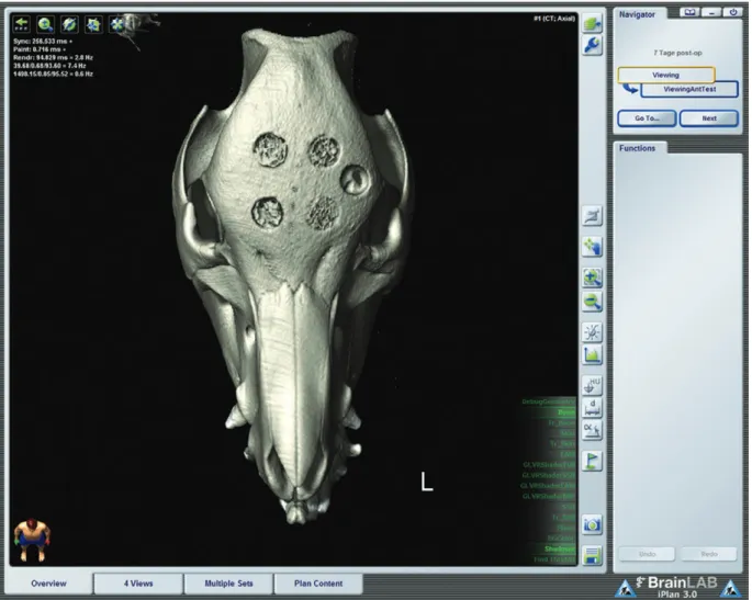 Fig. 4. in vivo 3D Ct scan of the head 1 week after placement of 5 craniotomies (exemplary scan, case 1, group 1)