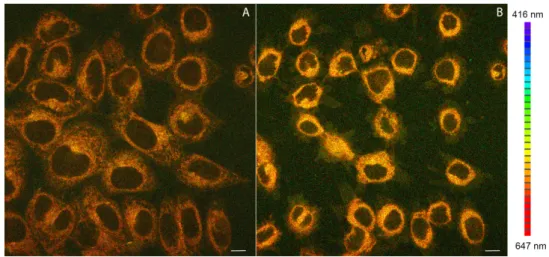Figure 5.  (A) Confocal luminescence image of living HeLa cells stained with 2; (B) View of the  photocytotoxic effect of 2 on HeLa cells after prolonged laser irradiation at 405 nm