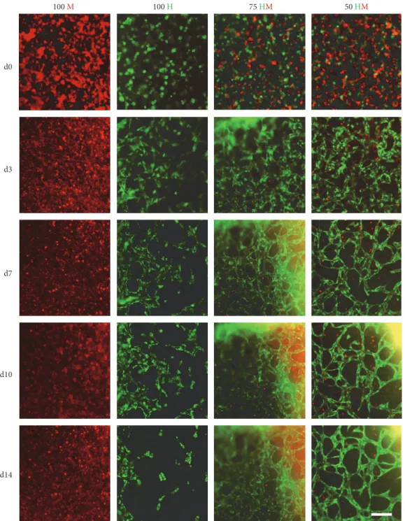 Figure 3: Time-lapse pictures of HUVEC and MSC mono- and cocultures. GFP-positive HUVECs (green) and PKH26 Red prestained MSCs were encapsulated in PRP (seeding density: 2.5 × 10 3 cells/μl gel) and time-lapse microscopy ran for two weeks