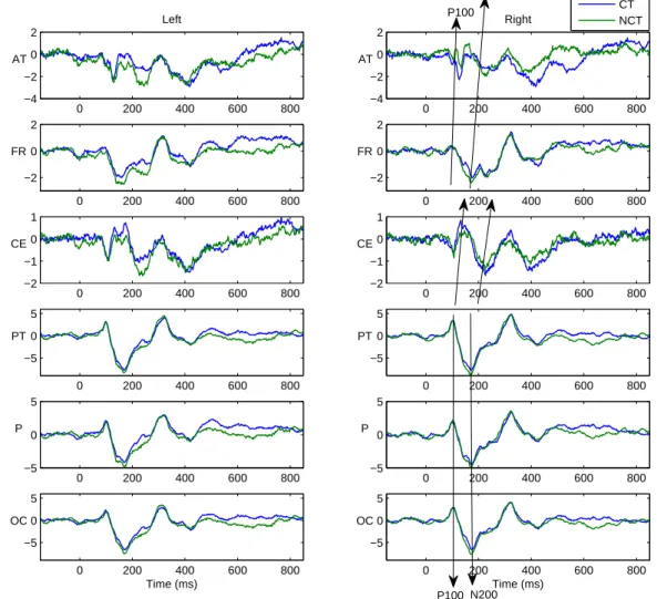 Figure 5.8 The pooled ERPs responses. The ERPs are averaged in pools of electrodes located on different regions.