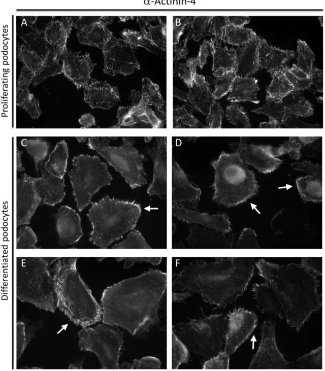 Fig.  4.3:  Immunostaining  of  proliferating  and  differentiated  hPCLs  with  -actinin-4  antibody;  (A,B)  Proliferating human podocytes stained with -actinin-4 antibody show -actinin-4 localization in lines  throughout  the  cell,  indicating  