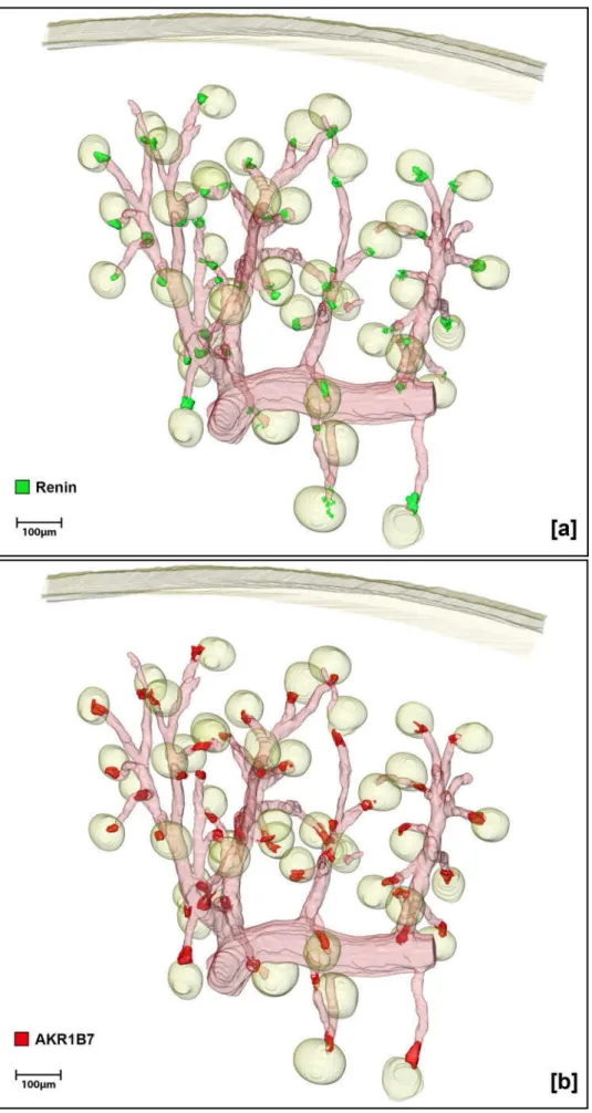 Abbildung  3.2:  [Gesamtansicht]  3D-Rekonstruktion  der  Glattmuskelaktin-  (rosa)  Immunreaktivität  im  repräsentativen  Gefäßbaumabschnitt  einer  Wildtyp-Maus  [NS]  mit  Darstellung  der  Glomeruli  und  der  Nierenkapsel (gelb)