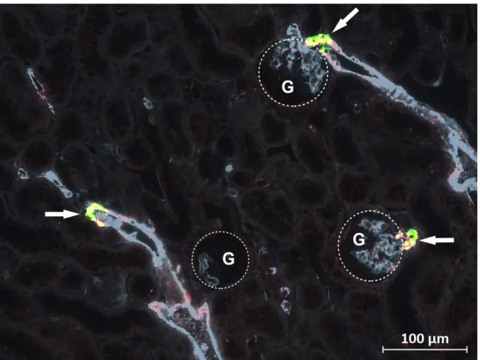 Abb. 3.4 zeigt exemplarisch drei Glomeruli mit dazugehörigen afferenten Arteriolen, in deren Wand  sich  die  Koexpression  von  Renin  und  AKR1B7  in  Form  gelb  erscheinender  Bereiche  äußert