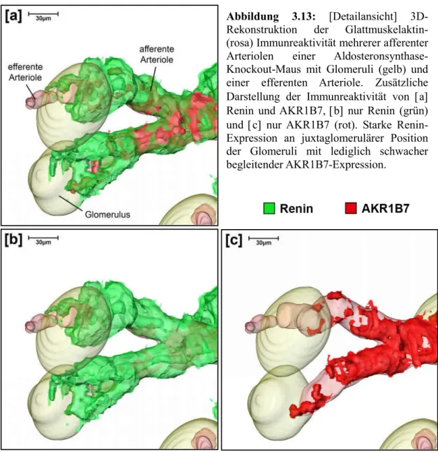 Abbildung  3.13:  [Detailansicht]  3D-  Rekonstruktion  der  Glattmuskelaktin-  (rosa) Immunreaktivität mehrerer afferenter  Arteriolen  einer   Aldosteronsynthase-Knockout-Maus  mit  Glomeruli  (gelb)  und  einer  efferenten  Arteriole