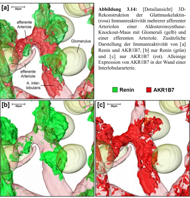 Abbildung  3.14:  [Detailansicht]  3D-  Rekonstruktion  der  Glattmuskelaktin-  (rosa) Immunreaktivität mehrerer afferenter  Arteriolen  einer   Aldosteronsynthase-Knockout-Maus  mit  Glomeruli  (gelb)  und  einer  efferenten  Arteriole