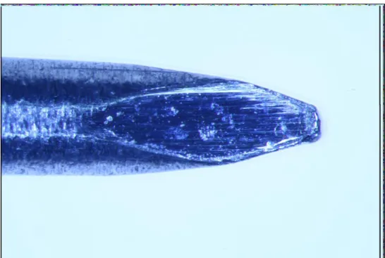 Abbildung  7:  Mit  Hilfe  des  Stackings  aus  den  oben  gezeigten  Einzelaufnahmen  errechnetes  Gesamtbild des Perforators 226604.