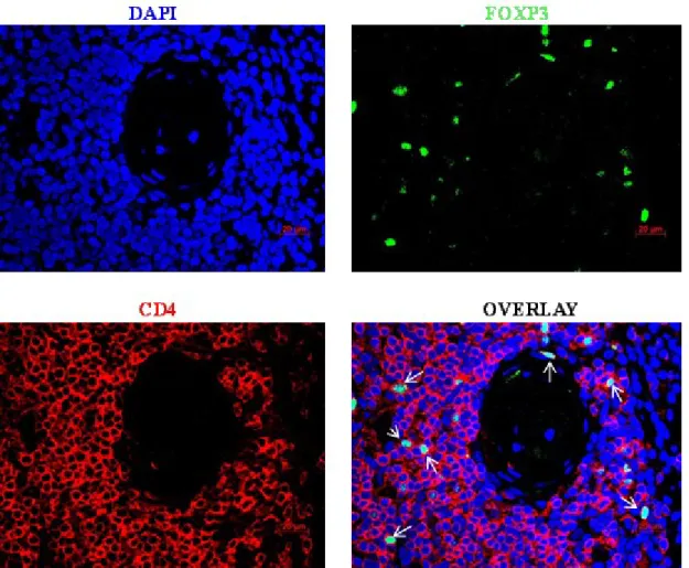 Figure 5.6: Foxp3 + CD4 +  double staining of thymus tissue.  