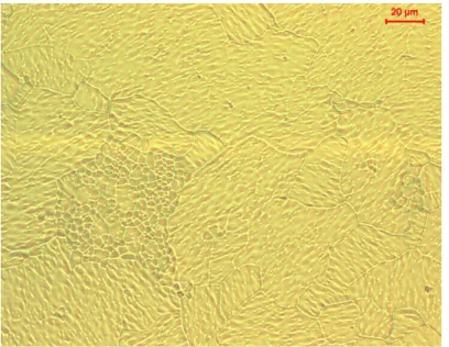 Abbildung 6.3: Kleinkornagglomarat mit einer Großkornumgebung