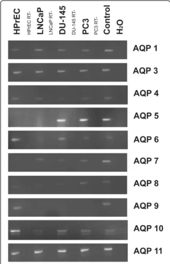 Fig. 1 AQP transcript expression: RT-PCR results of AQP 0 – 12 in normal prostate epithelial cells (HPrEC) and in established PC lines (LNCaP, DU-145 and PC3)