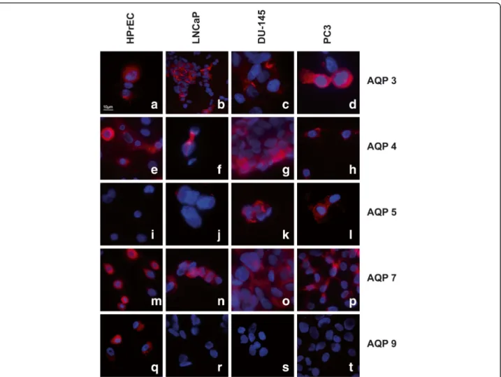 Fig. 2 Immunofluorescence labelling of HPrEC, LNCaP, DU-145 and PC3 cell lines. Intense expression of AQP 3 (a-d) AQP 4 (e-h) and AQP 7 (m-p) in all cell lines